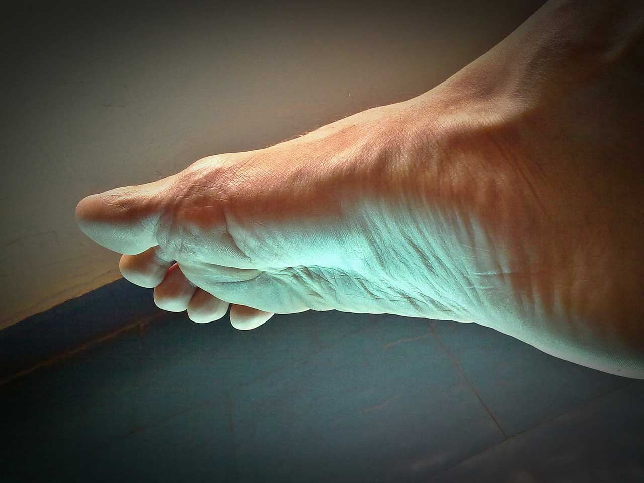 Ankle Pain - Achilles Foot Clinic