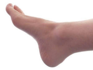  Diabetic Neuropathy - Achilles Foot Clinic