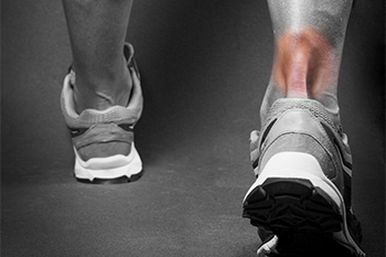 Achilles Tendon - Achilles Foot Clinic