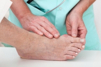 Possible Causes of Bunions