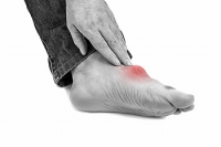 What to Do During a Gout Attack