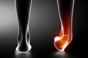 Why Visiting a Podiatrist for an Ankle Sprain Is Important