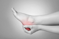 Causes of Plantar Fasciitis