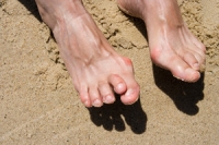 Is Hammertoe A Deformity?